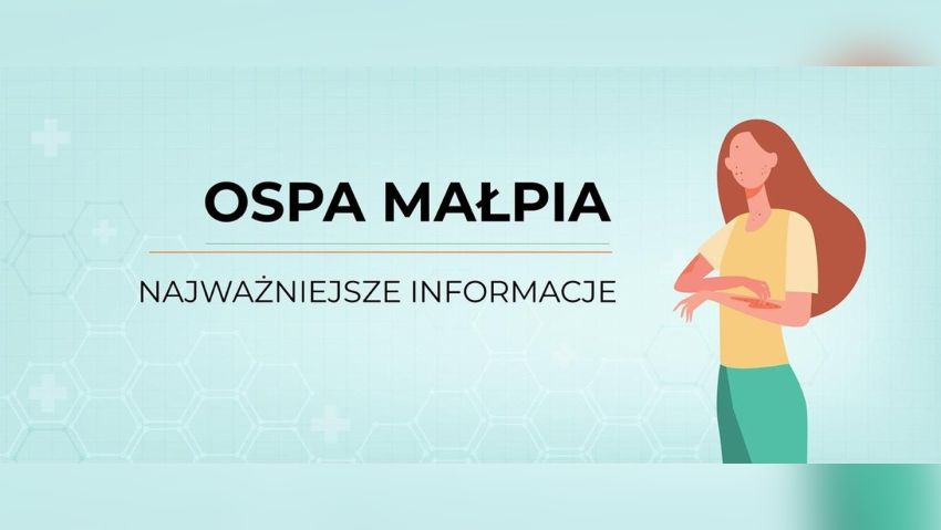 Postać kobiety z krostami, napis - Ospa małpia - najważniejsze informacje