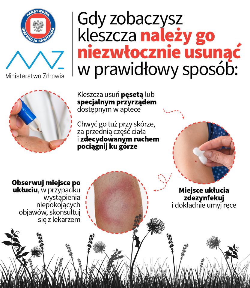 Grafika przedstawia w jaki sposób należy prawidłowo usunąć kleszcza